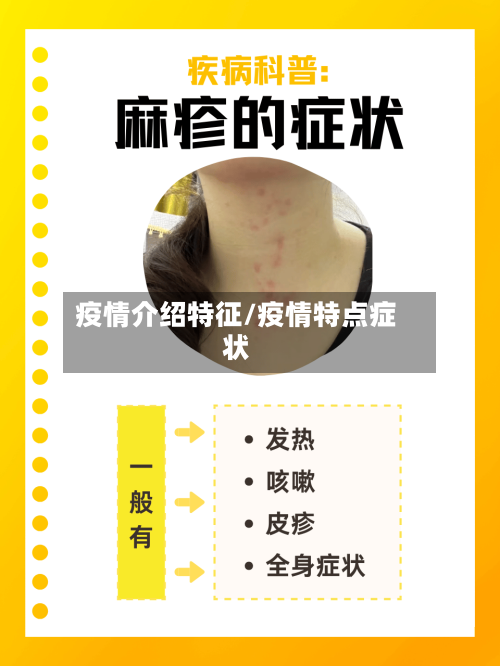 疫情介绍特征/疫情特点症状-第3张图片