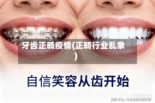 牙齿正畸疫情(正畸行业乱象)-第1张图片